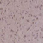 Immunohistochemical staining of human cerebral cortex shows moderate to strong granular cytoplasmic positivity in neurons.
