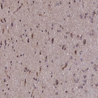 Immunohistochemical staining of human cerebral cortex shows moderate to strong granular cytoplasmic positivity in neurons.