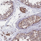 Immunohistochemical staining of human testis shows moderate to strong granular cytoplasmic positivity in cells in seminiferous ducts.