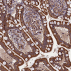 Immunohistochemical staining of human gastrointestinal shows moderate to strong granular cytoplasmic positivity in glandular cells.