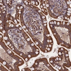 Immunohistochemical staining of human gastrointestinal shows moderate to strong granular cytoplasmic positivity in glandular cells.