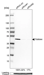 Western blot analysis in Caco-2 cells transfected with control siRNA, target specific siRNA probe #1 and #2, using Anti-TIMM44 antibody. Remaining relative intensity is presented. Loading control: Anti-PPIB.
