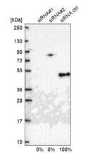Western blot analysis in U2OS cells transfected with control siRNA, target specific siRNA probe #1 and #2, using Anti-TIMM44 antibody. Remaining relative intensity is presented