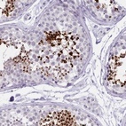 Anti-LRRC37A Antibody