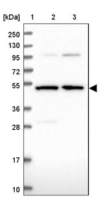 Lane 1: Marker [kDa] 250, 130, 95, 72, 55, 36, 28, 17, 10_br/_Lane 2: Human cell line RT-4_br/_Lane 3: Human cell line U-251MG sp