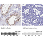 Anti-GLB1L Antibody