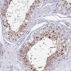 Immunohistochemical staining of human testis shows high expression.