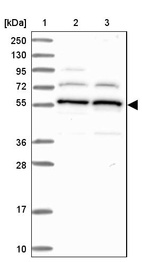 Lane 1: Marker [kDa] 250, 130, 95, 72, 55, 36, 28, 17, 10_br/_Lane 2: Human cell line RT-4_br/_Lane 3: Human cell line U-251MG sp