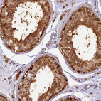 Anti-SAMD4A Antibody