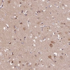 Immunohistochemical staining of human cerebral cortex shows moderate cytoplasmic positivity in neuronal cells.