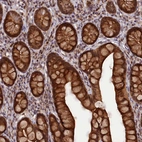 Immunohistochemical staining of human gastrointestinal shows strong cytoplasmic positivity in glandular cells.