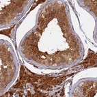 Anti-ARL2BP Antibody