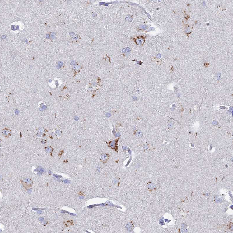 Anti-HS2ST1 Antibody