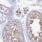 Immunohistochemical staining of human testis shows strong granular cytoplasmic positivity in Leydig cells.
