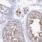 Immunohistochemical staining of human testis shows strong granular cytoplasmic positivity in Leydig cells.