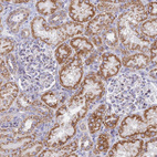 Immunohistochemical staining of human kidney shows moderate granular cytoplasmic positivity in cells in tubules.
