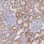Immunohistochemical staining of human kidney shows moderate granular cytoplasmic positivity in cells in tubules.