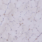 Immunohistochemical staining of human skeletal muscle shows no positivity in myocytes as expected.