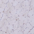 Immunohistochemical staining of human skeletal muscle shows no positivity in myocytes as expected.
