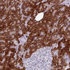 Anti-BMS1 Antibody