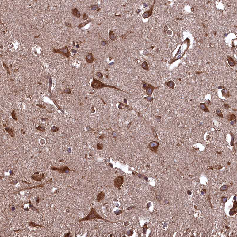 Anti-PLA2G4C Antibody