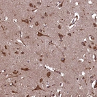Anti-PLA2G4C Antibody