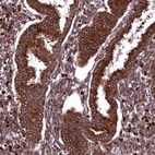 Immunohistochemical staining of human endometrium shows strong cytoplasmic positivity in glandular cells.