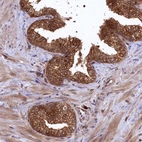 Immunohistochemical staining of human prostate shows strong membranous and cytoplasmic positivity in glandular cells.