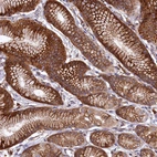 Immunohistochemical staining of human stomach shows strong membranous and cytoplasmic positivity in glandular cells.