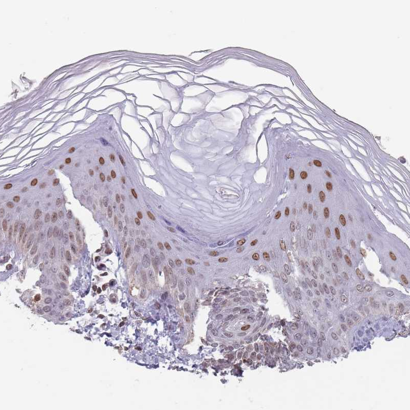 Anti-MFSD12 Antibody