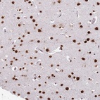 Anti-MFSD12 Antibody