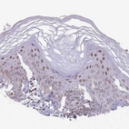 Anti-MFSD12 Antibody