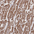 Immunohistochemical staining of human heart muscle shows strong cytoplasmic positivity in cardiomyocytes.