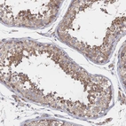 Immunohistochemical staining of human testis shows moderate cytoplasmic positivity in cells in seminiferous ducts.