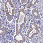 Anti-SORBS1 Antibody