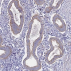 Immunohistochemical staining of human endometrium shows moderate cytoplasmic positivity in glandular cells.