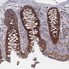 Immunohistochemical staining of human colon shows strong cytoplasmic positivity in glandular cells.