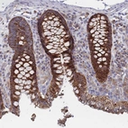 Immunohistochemical staining of human colon shows strong cytoplasmic positivity in glandular cells.