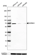 Western blot analysis in Caco-2 cells transfected with control siRNA, target specific siRNA probe #1 and #2, using Anti-SORBS1 antibody. Remaining relative intensity is presented. Loading control: Anti-GAPDH.