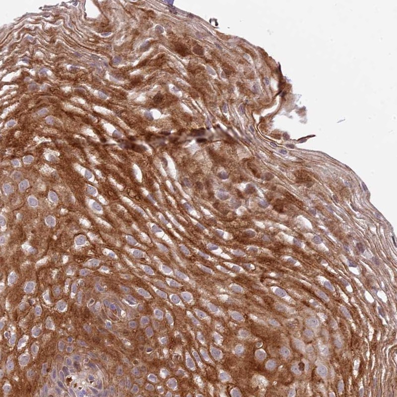 Anti-DEFB125 Antibody