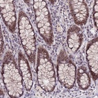 Anti-NSMCE1 Antibody