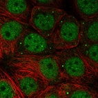 Immunofluorescent staining of human cell line MCF7 shows localization to nucleoplasm & vesicles.