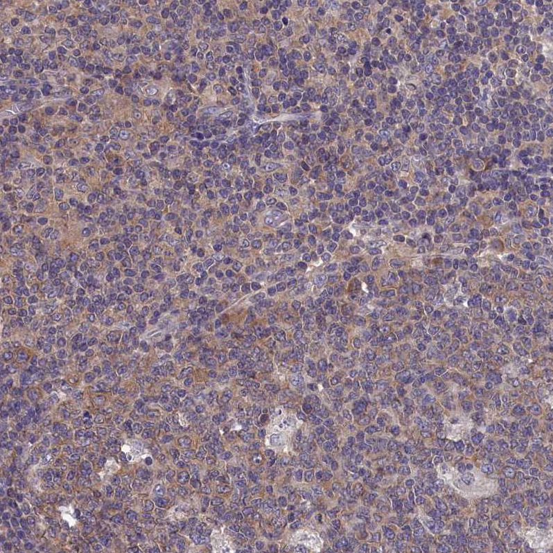 Anti-PGP Antibody