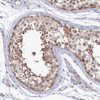 Immunohistochemical staining of human Testis shows moderate cytoplasmic positivity in cells in seminiferous ducts.