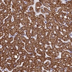 Immunohistochemical staining of human Liver shows strong cytoplasmic positivity in hepatocytes.