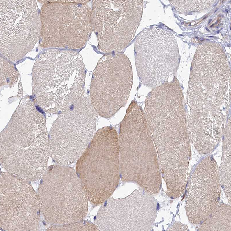 Anti-ABCC12 Antibody