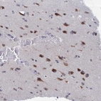 Immunohistochemical staining of human Cerebral cortex shows moderate cytoplasmic positivity in neuronal cells.