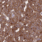 Anti-KANSL1L Antibody