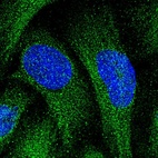 Immunofluorescent staining of human cell line U-2 OS shows localization to cytosol.