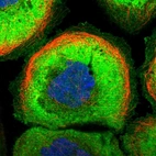 Immunofluorescent staining of human cell line A-431 shows localization to plasma membrane & cytosol.